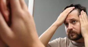 Wie man Alopezie behandelt und Haarausfall vorbeugt