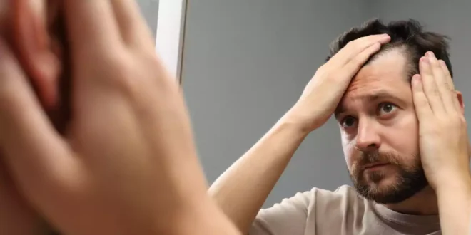 Wie man Alopezie behandelt und Haarausfall vorbeugt Wie man Alopezie behandelt und Haarausfall vorbeugt