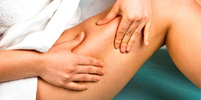Cellulite: Was es ist, warum es bei Frauen auftritt, Ursachen, wie man sie loswird