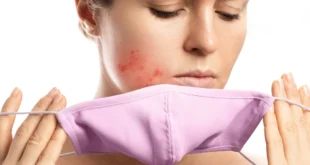 Was ist Maskné und wie kann ich es behandeln?