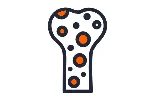 Verminderung der Knochendichte