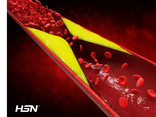 Welchen Einfluss hat Cholesterin?