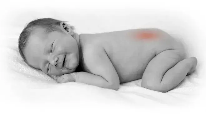 Wozu dient Fols&auml;ure