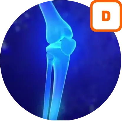 Einfluss von Vitamin D auf die Knochenentwicklung